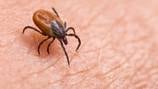 Allegheny County child tests positive for rare tickborne disease, health officials say 