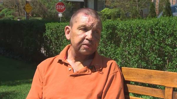 Man attacked inside his Sewickley home speaks out about terrifying ordeal 