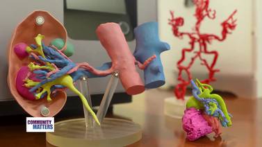 UPMC Community Matters: The benefits of 3D models in health care