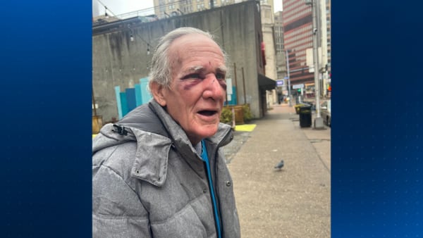 Man, 71, randomly attacked in downtown Pittsburgh, police say