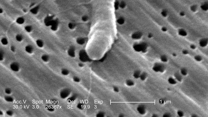 5 die this year from flesh-eating bacteria in Louisiana