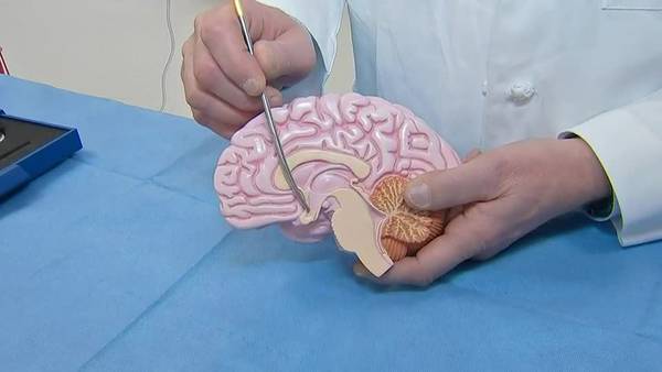 Could brain surgery help with obesity? AHN doctors investigate